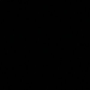 Meet your Posher, Treasure